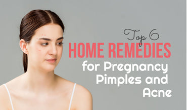 Top 6 Home Remedies for Pregnancy Pimples